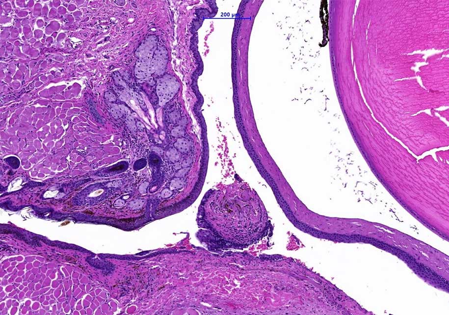 Pathology tissue sample showing a close-up of large pink and white area.